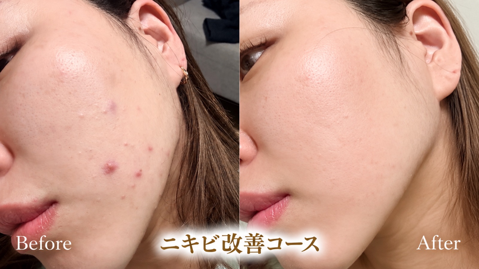 Lecherienの写真 5