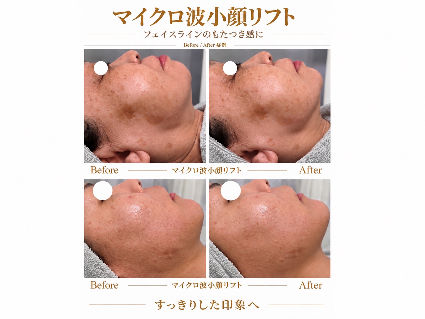 Lecherienの写真 4