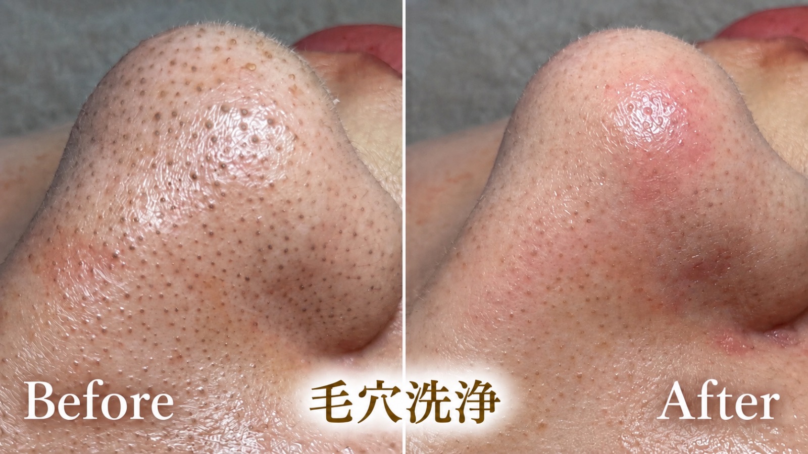 Lecherienの写真 7