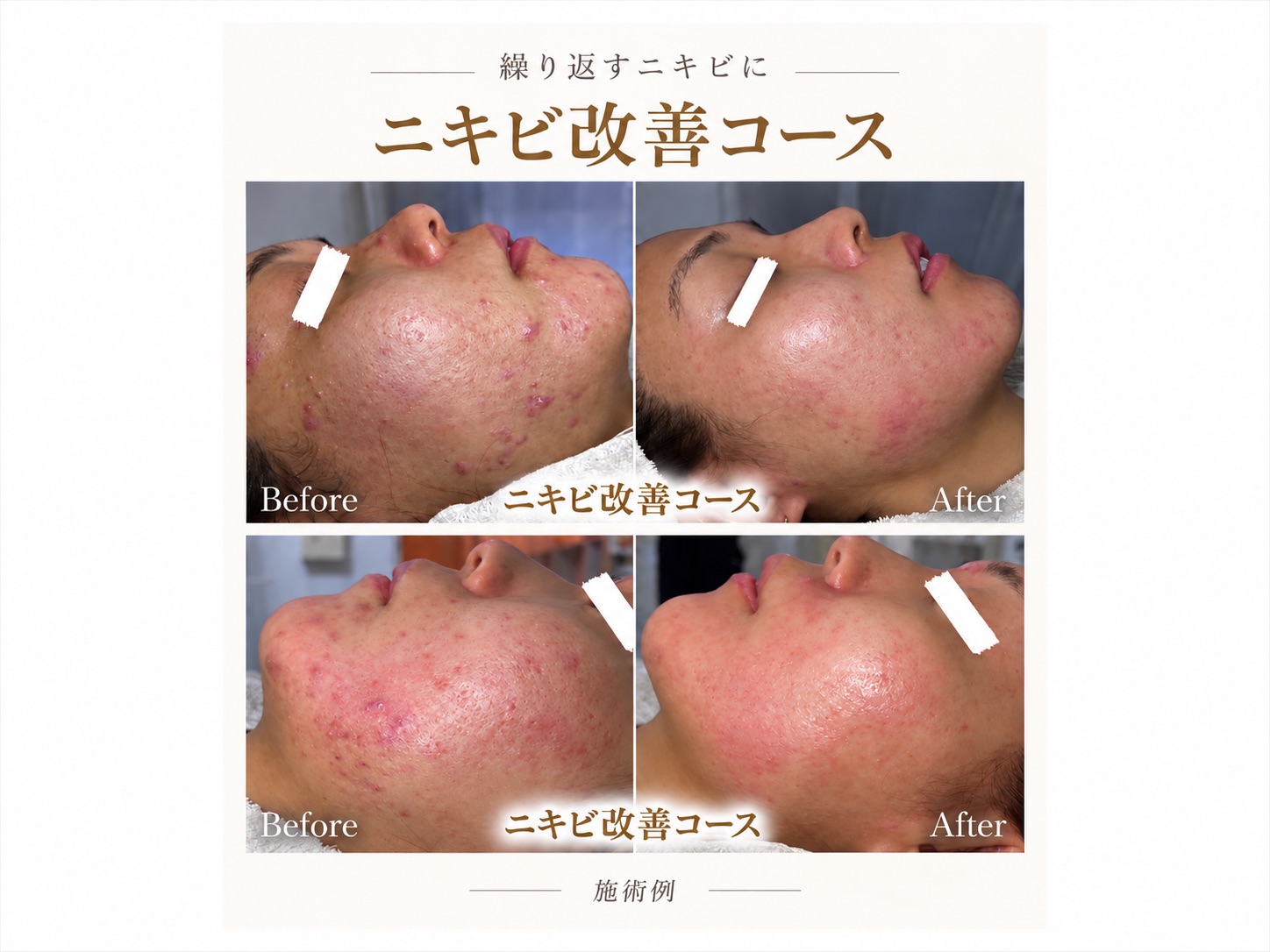 Lecherienの写真 3
