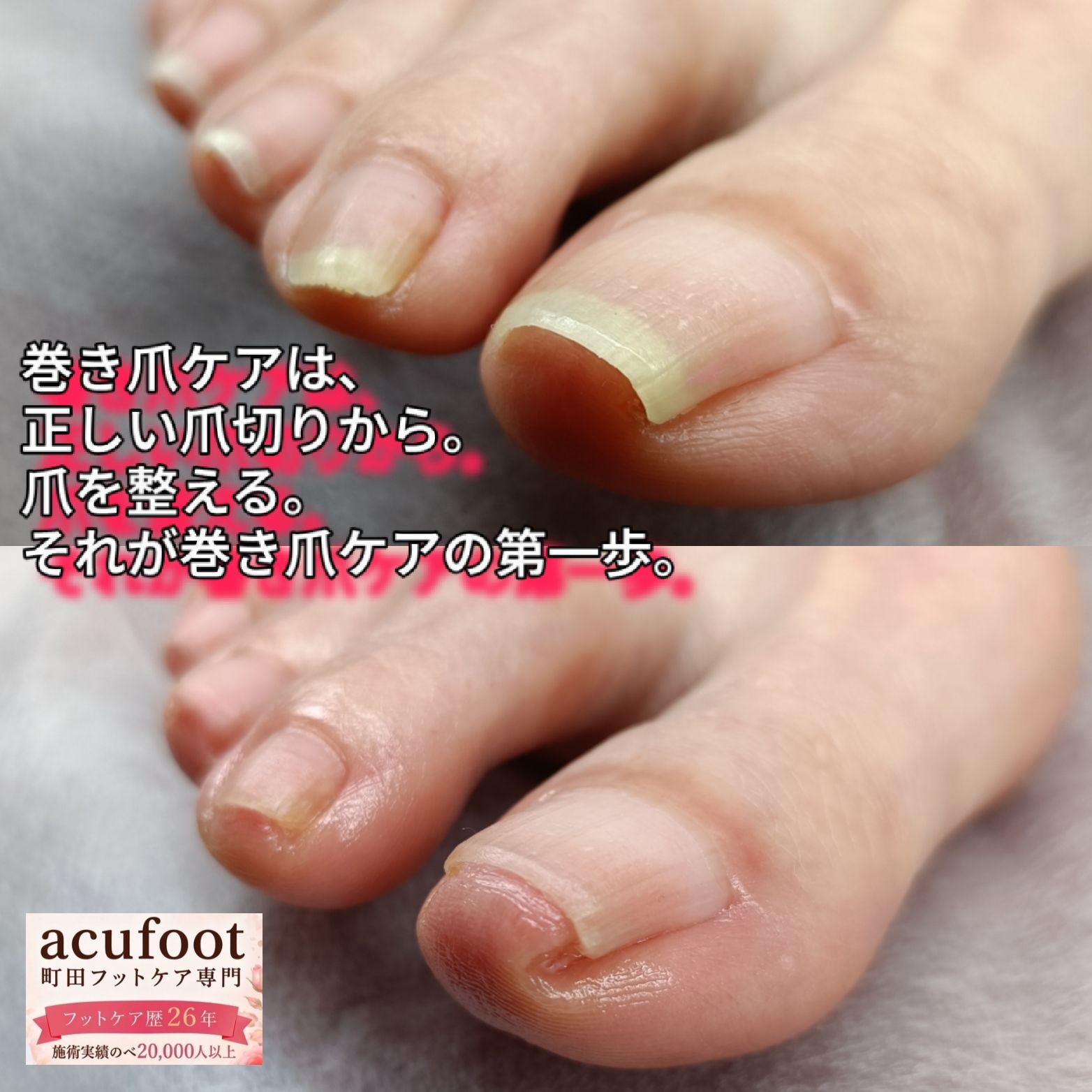 acufoot 町田フットケア専門の写真 2