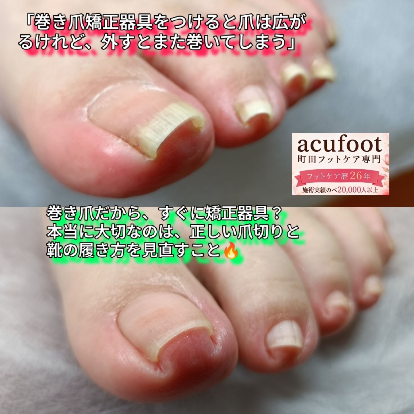 acufoot 町田フットケア専門の写真 4