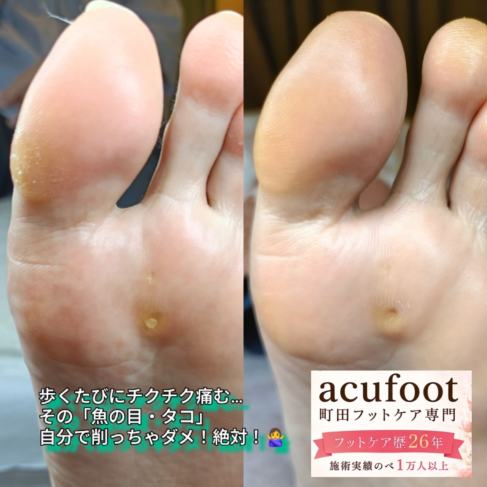 acufoot 町田フットケア専門の写真 7