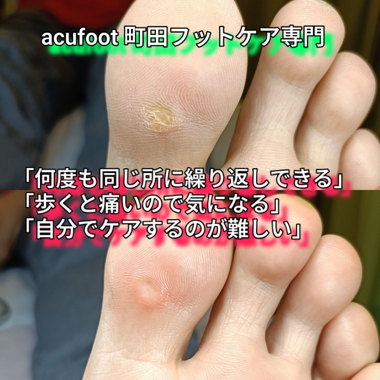 acufoot 町田フットケア専門の写真 8