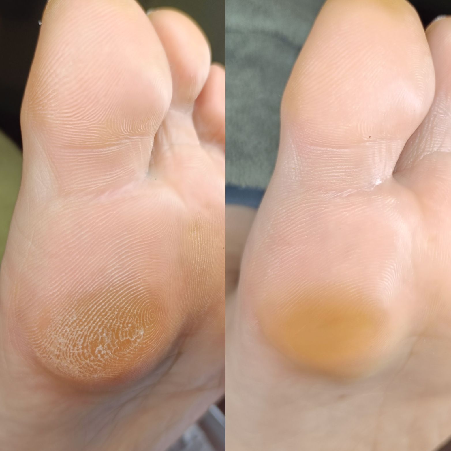 acufoot 町田フットケア専門の写真 10