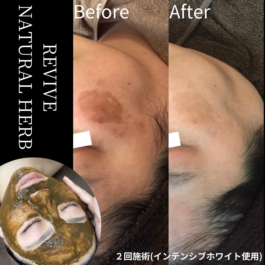 LINO waxing salonの写真 6